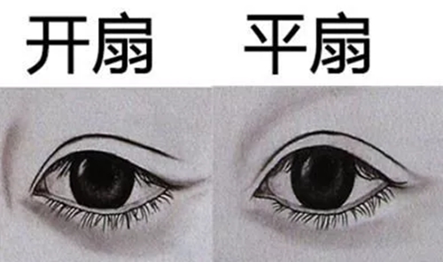 韩国双眼皮手术类型