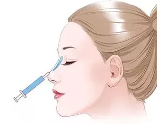 注射玻尿酸隆鼻鼻子会变宽吗