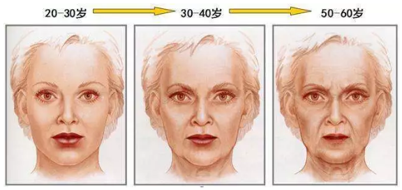 面部衰老过程示意图