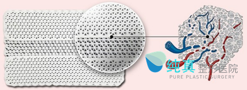 韩国纯真整形外科mesh假体材料内部结构