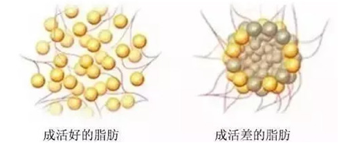 成活好和成活差脂肪的区别